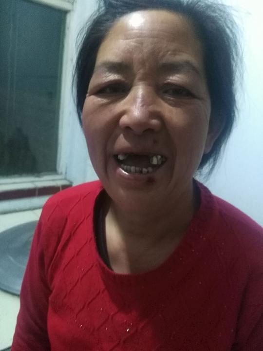Gđa Hang Shizhen je izgubila četiri prednja zuba kad su je pretukli 