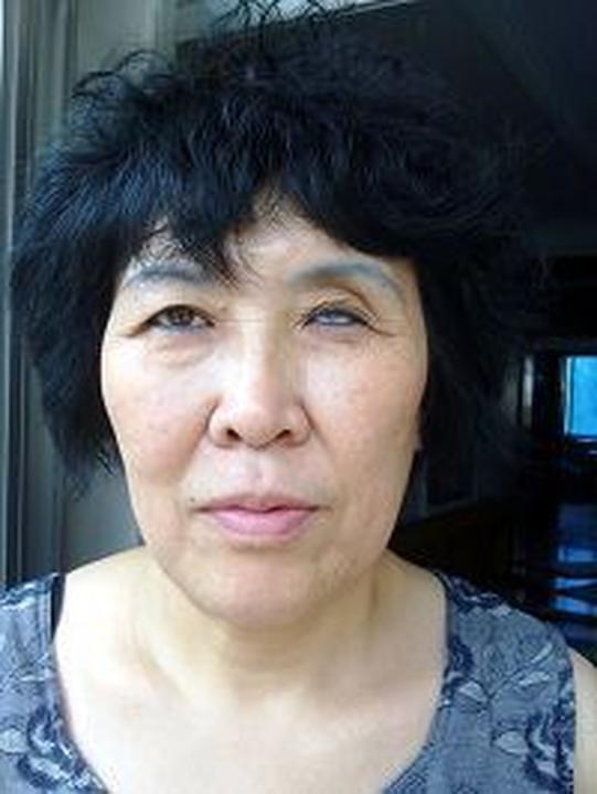  Gospođa Zhang Chunyu je oslijepila na lijevo oko zbog zlostavljanja u radnom logoru Wanjia.